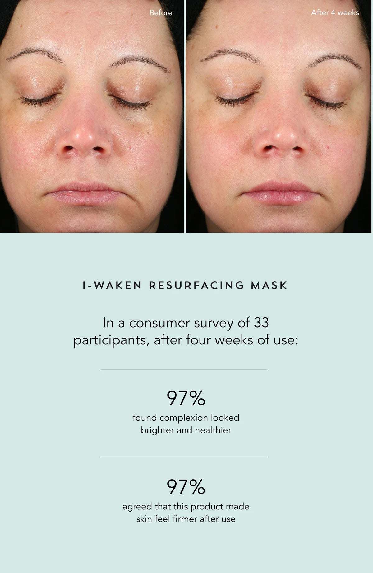 I-Waken Resurfacing Mask