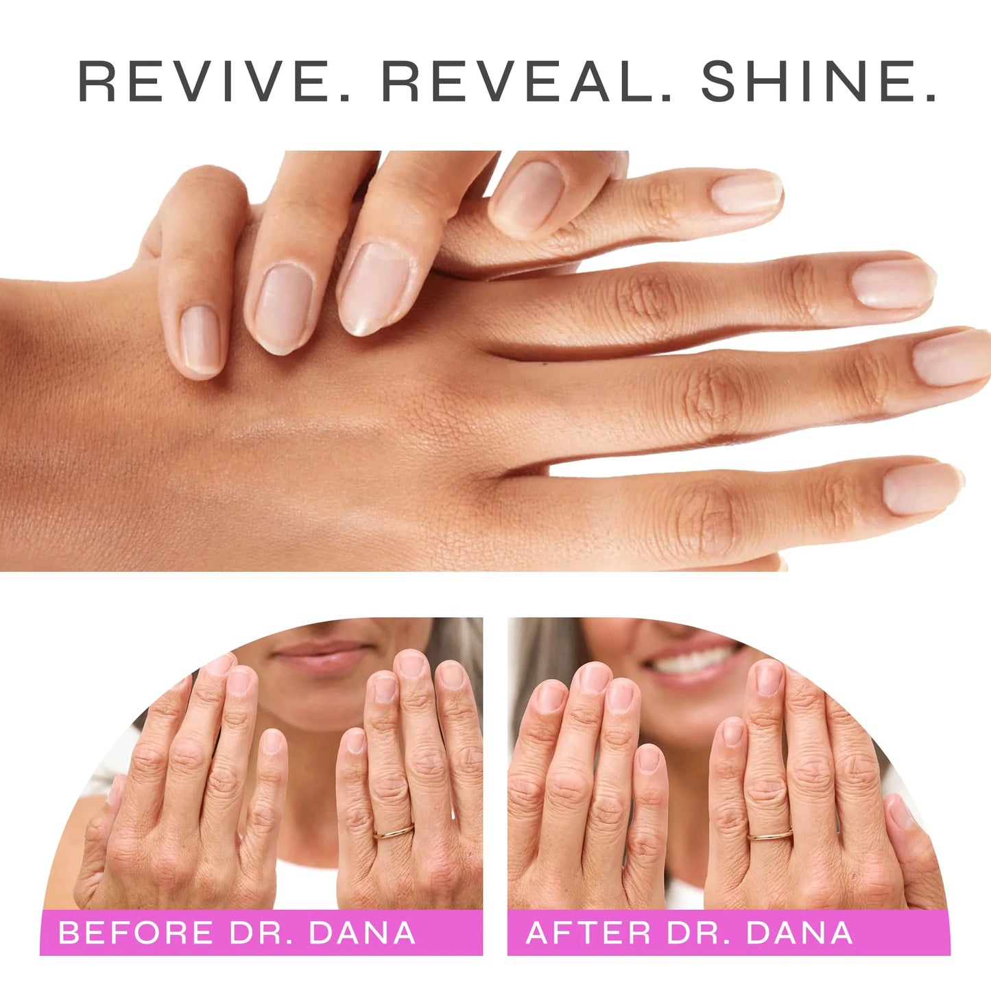 Nail Renewal System