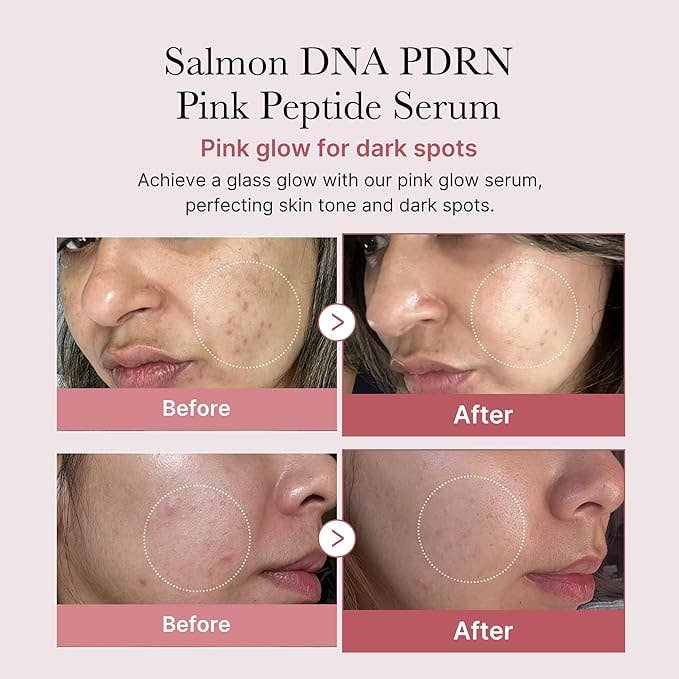 Salmon DNA PDRN Pink Peptide Serum 30ml 1.01 fl.oz.