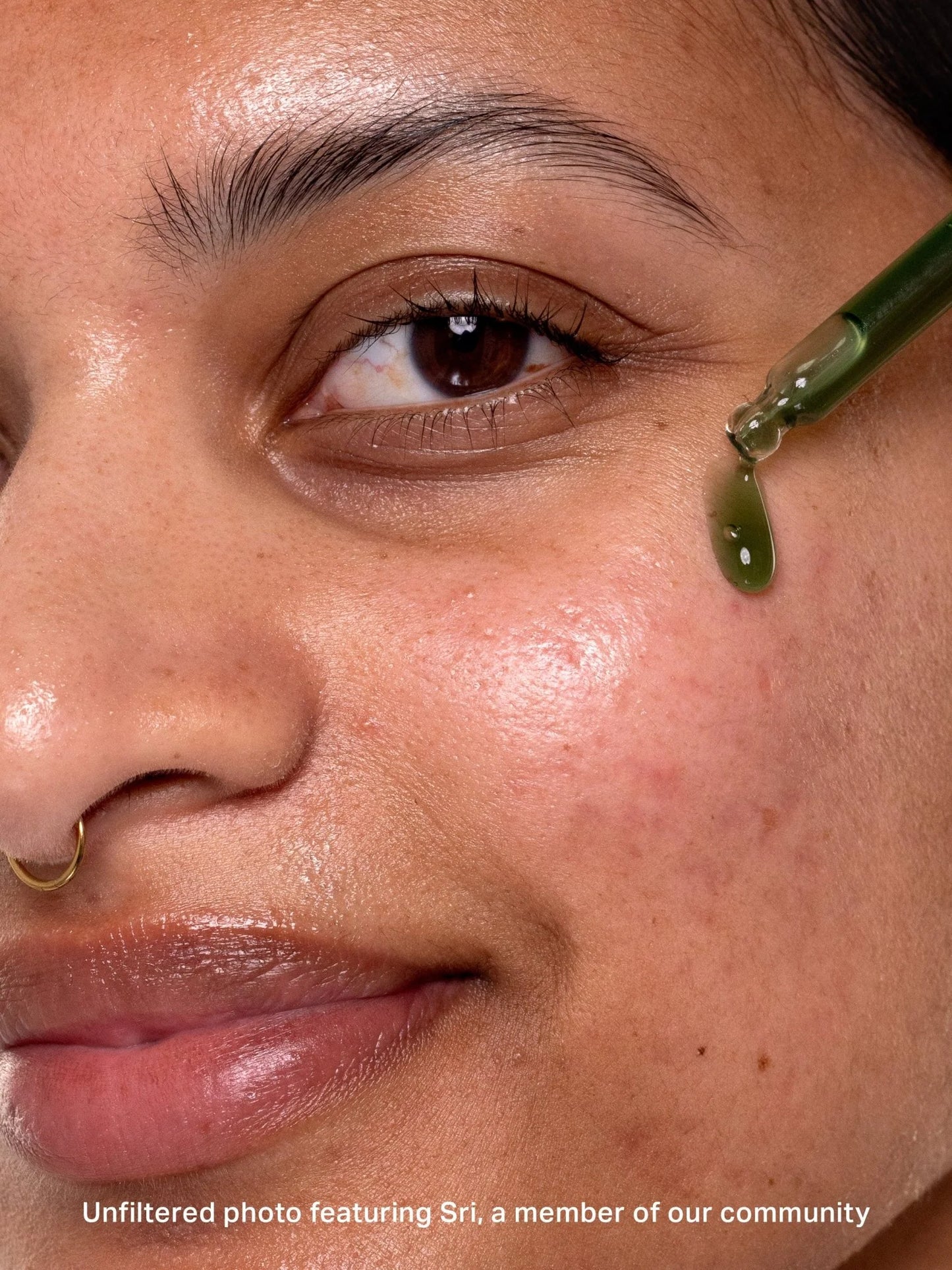 Chlorophyll Discoloration Serum with 1% Alpha Arbutin