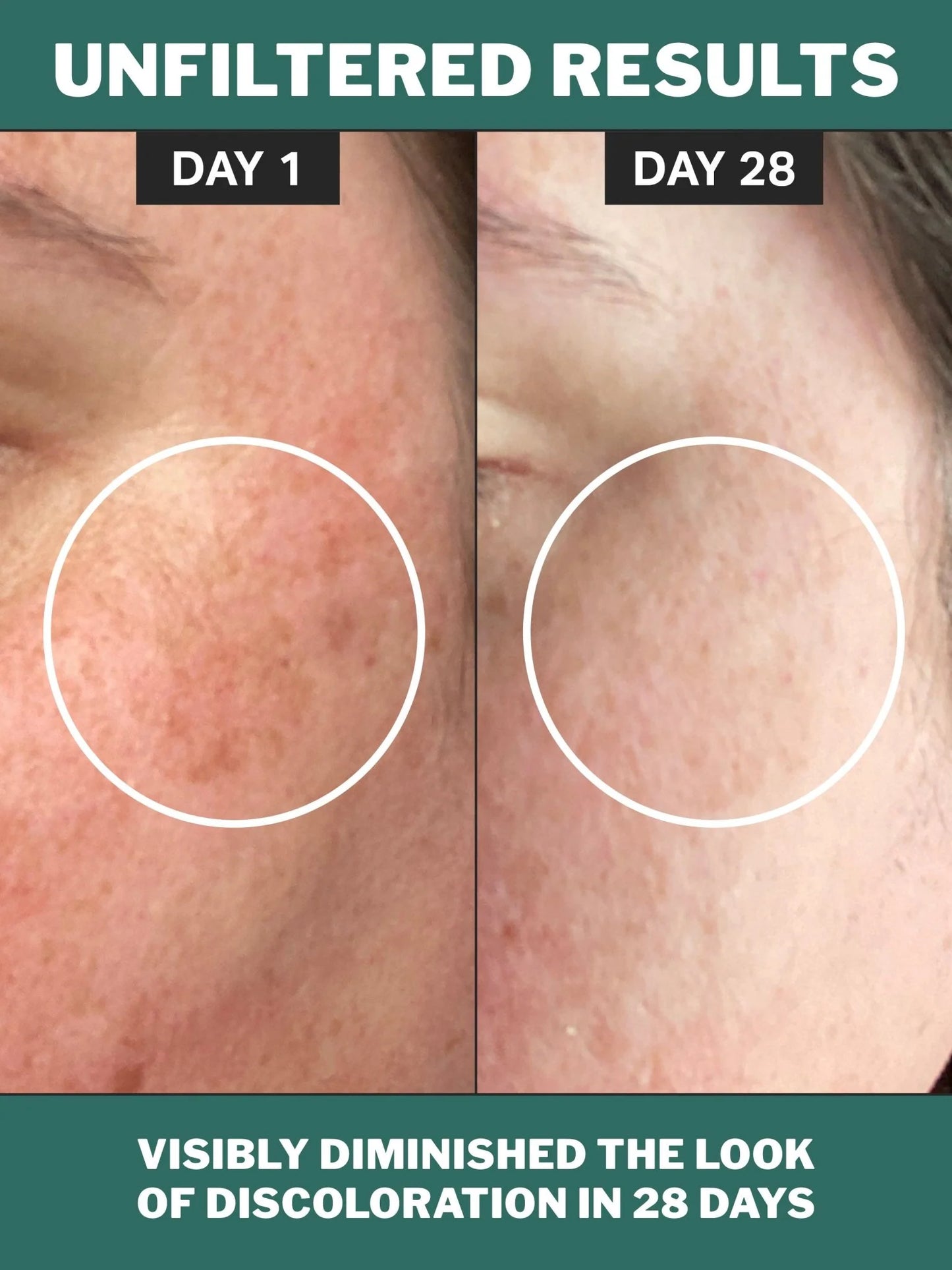Chlorophyll Discoloration Serum with 1% Alpha Arbutin