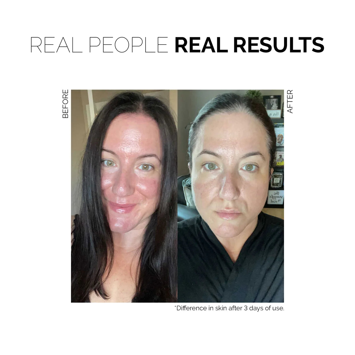 Redness Rescue Cream