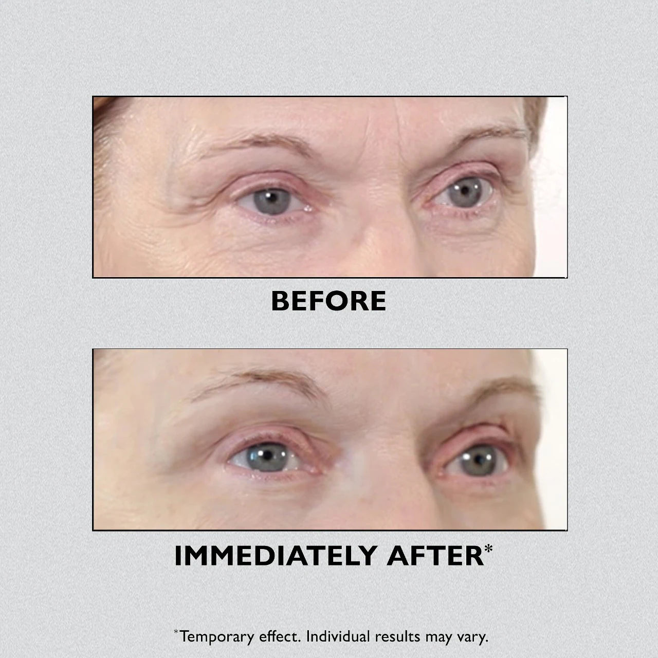 Instant FirmX Temporary Eye Tightener