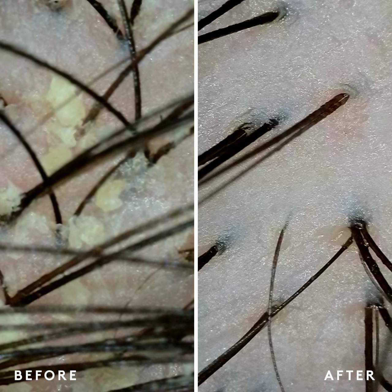 Scalp Remedy Shampoo