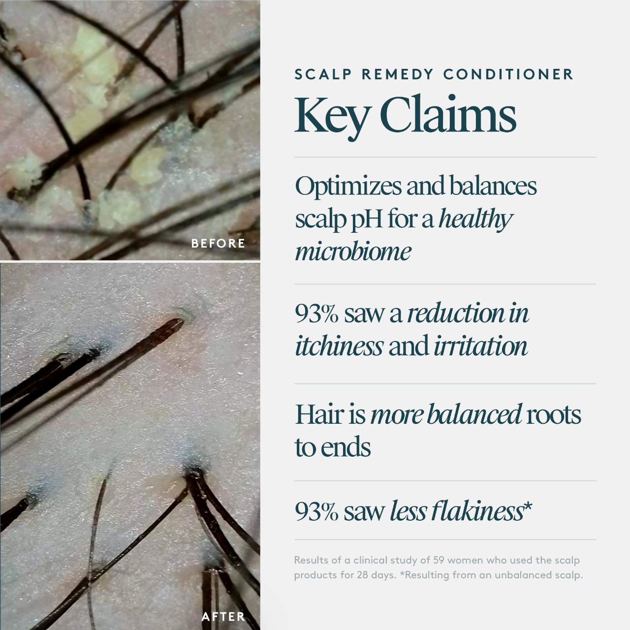 Scalp Remedy Conditioner