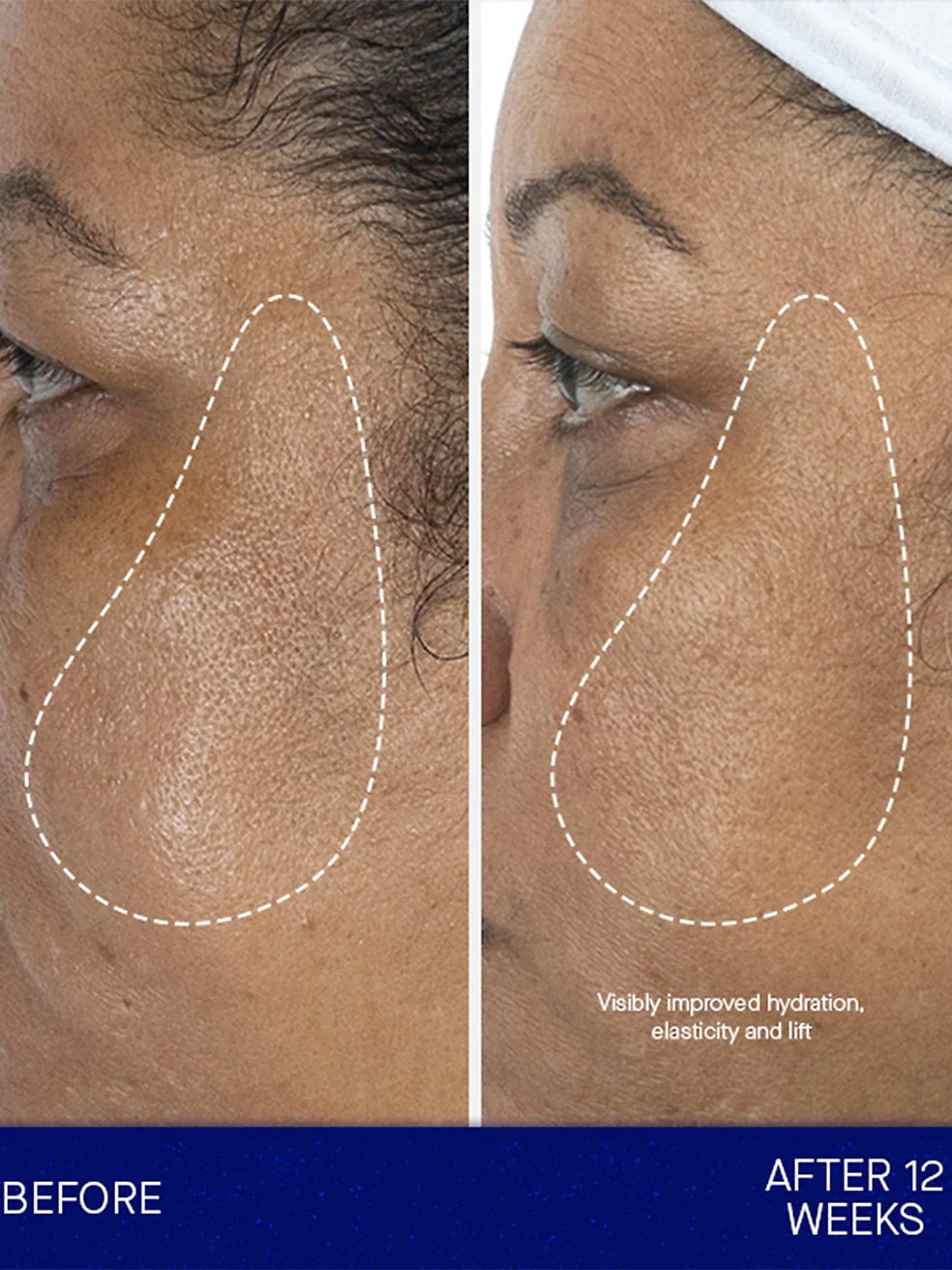 The Eye Cream