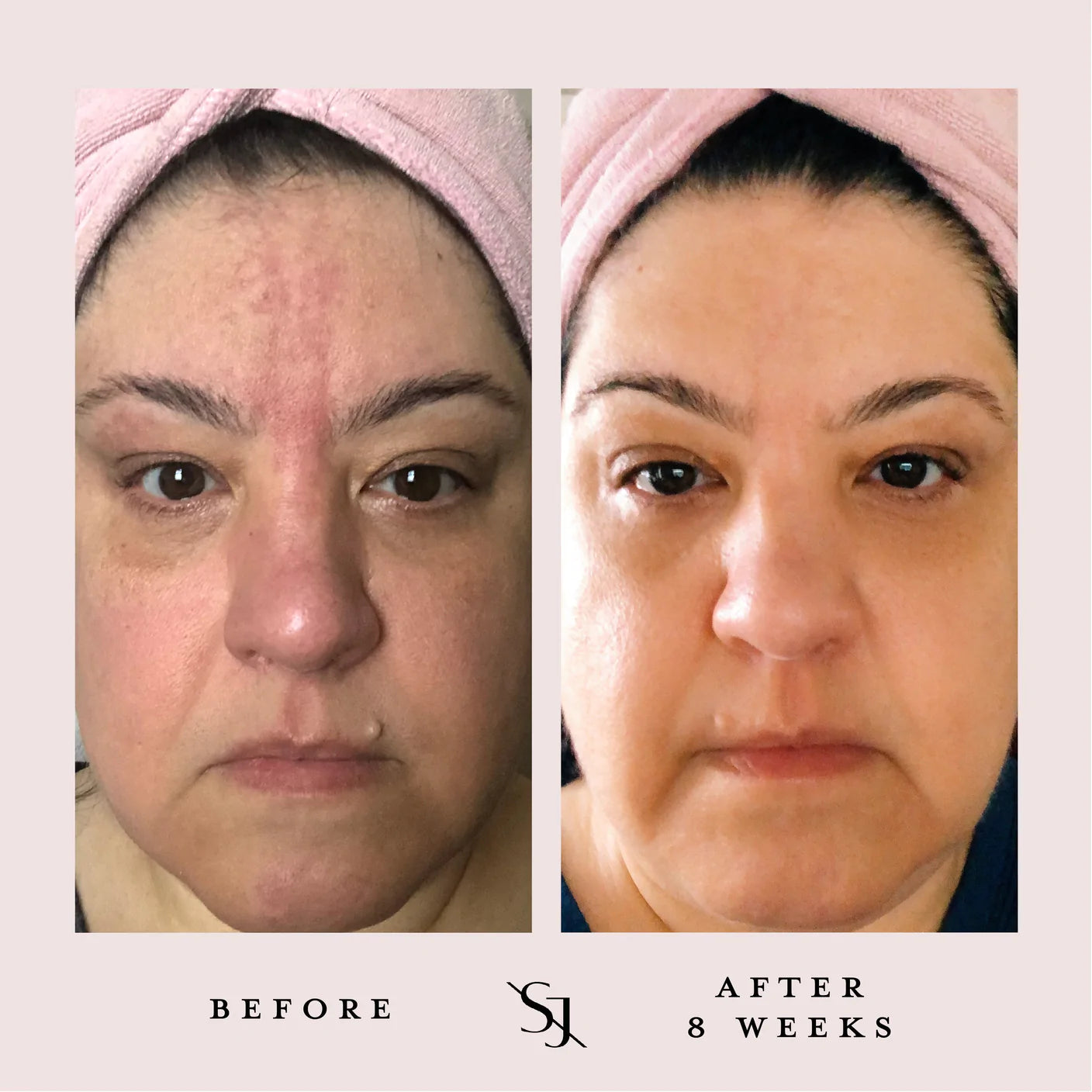 Luxury Beauty Serum Powerful Calming Treatment