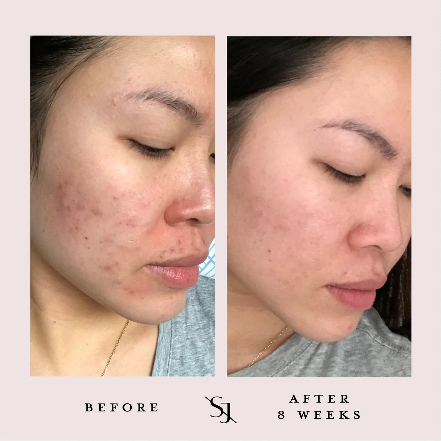 Luxury Beauty Serum Powerful Calming Treatment
