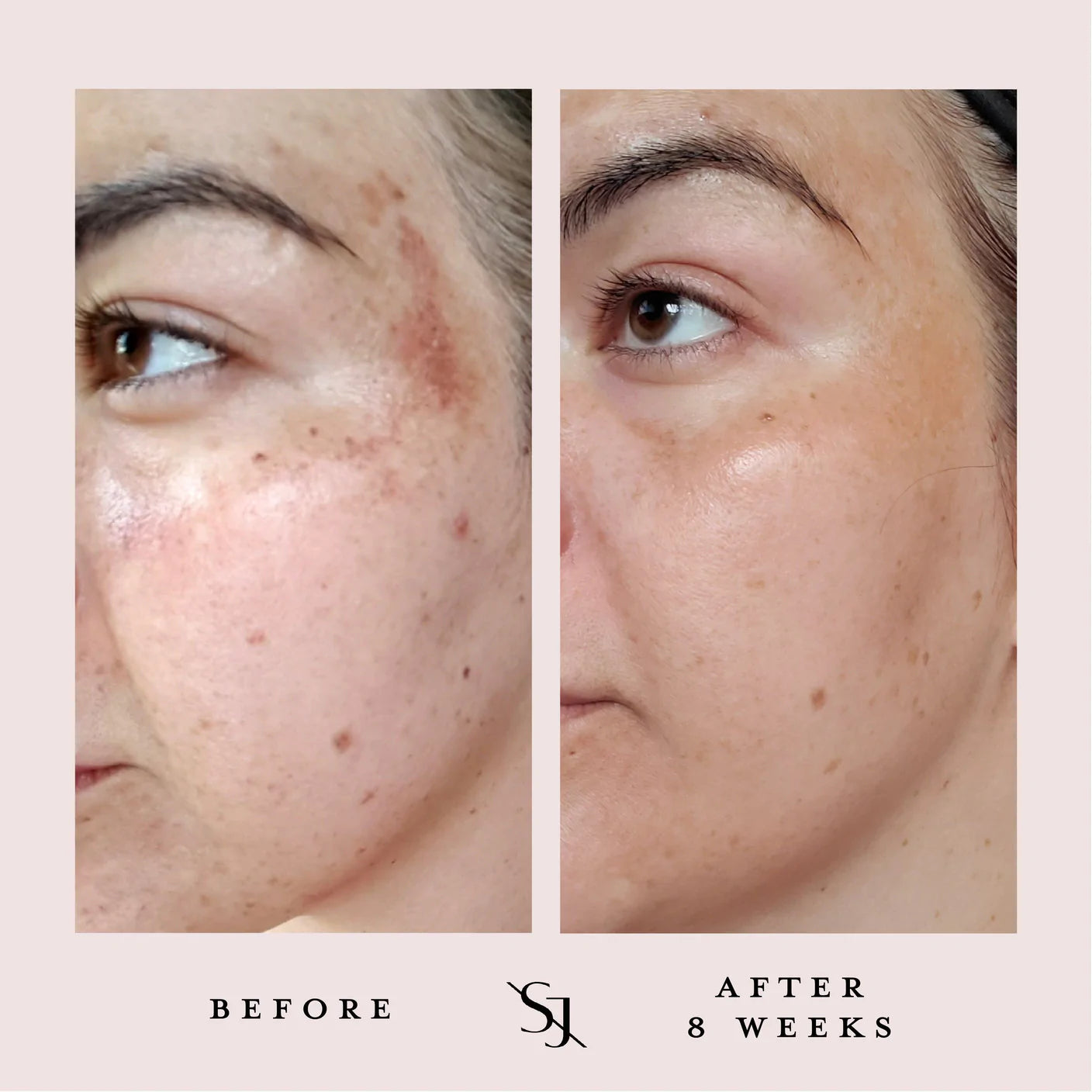 Luxury Beauty Serum Powerful Calming Treatment