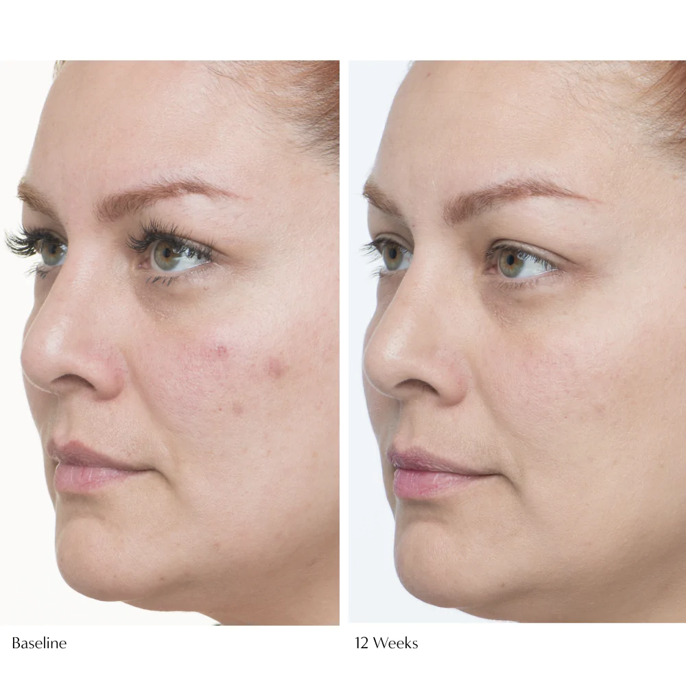 Plumscreen Broad Spectrum SPF 31 UVA/UVB/HEV PA+++