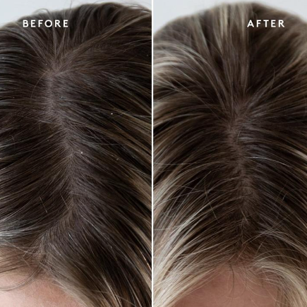 EXFOLIATING Scalp Treatment