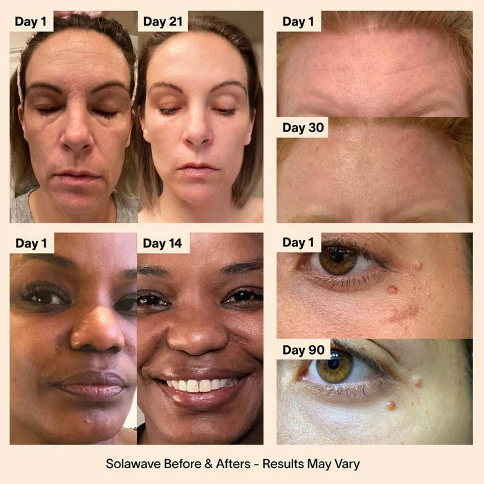 Advanced Skincare Wand with Red Light Therapy
