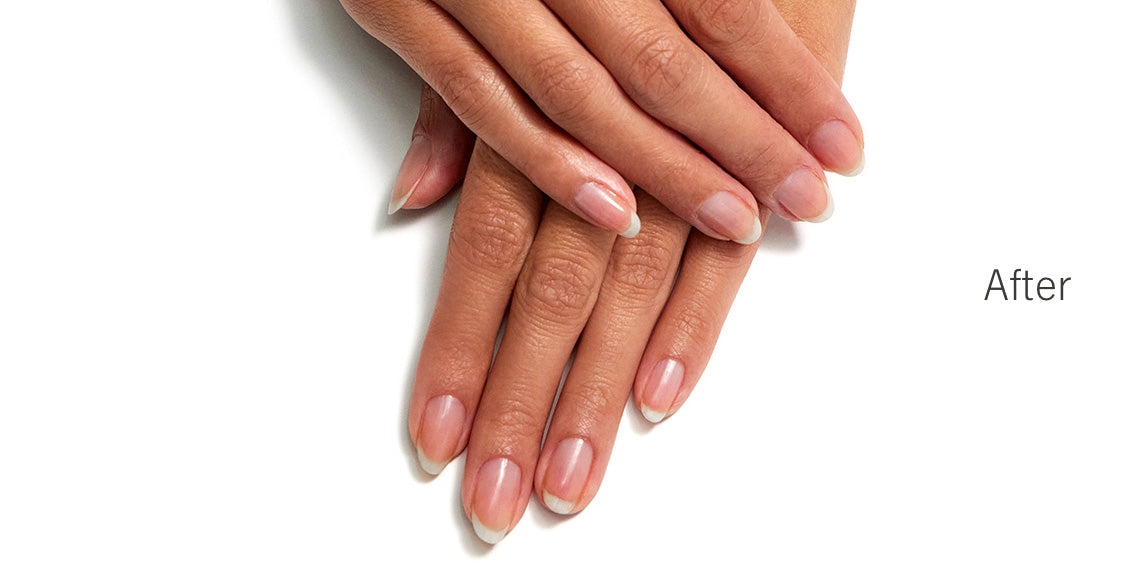 Nail Renewal System