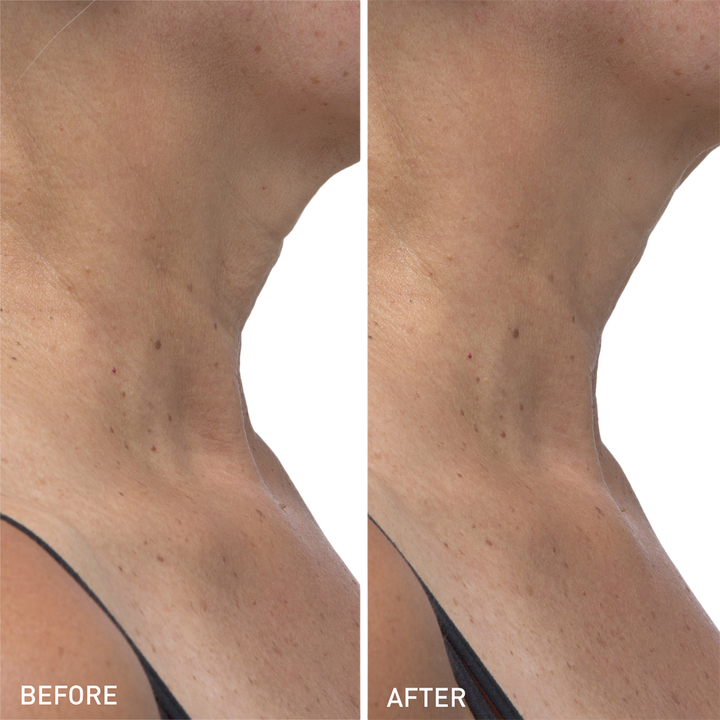 Hydro Cool Firming Neck Gels