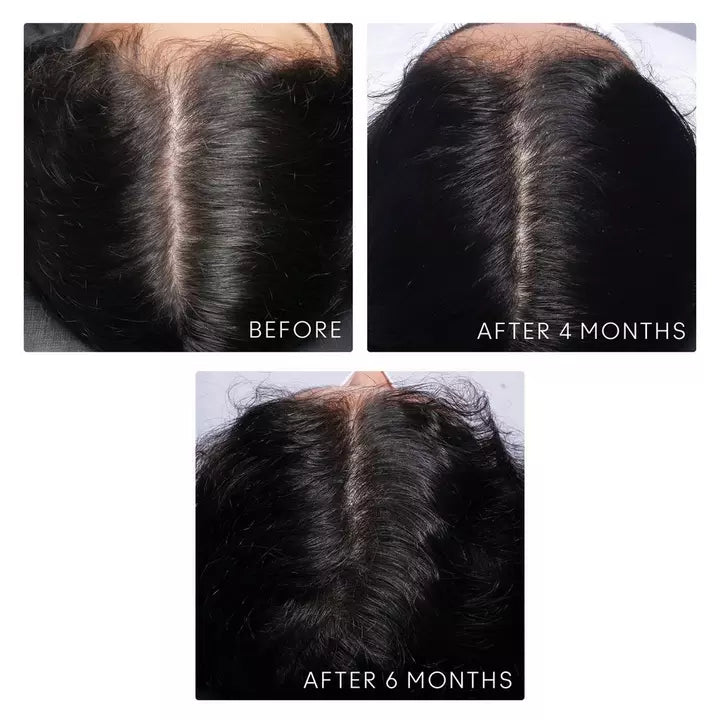 FLOURISH Density Booster - For Thinning Hair