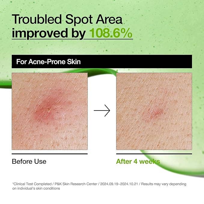 ANUA Azelaic Acid 10 Hyaluron Redness Soothing Serum