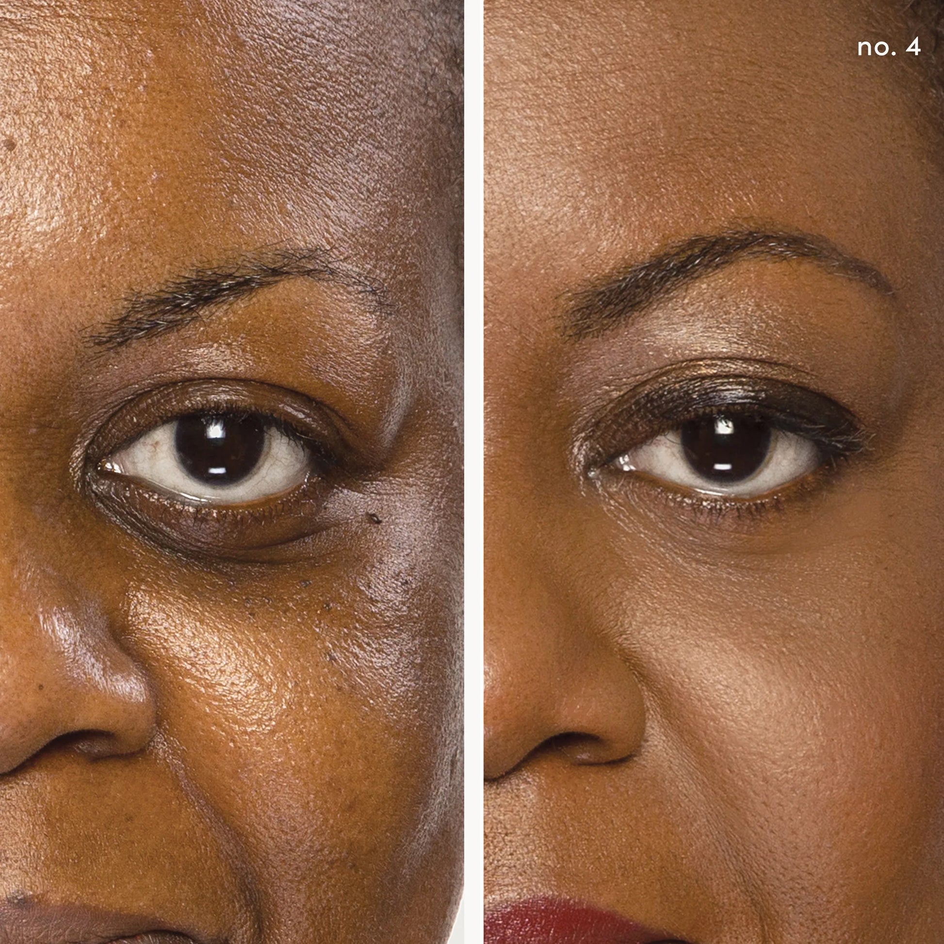 Circle\Delete® Concealer: Before and after showing bare skin versus makeup-enhanced complexion, highlighting its spot-correcting and brightening capabilities.