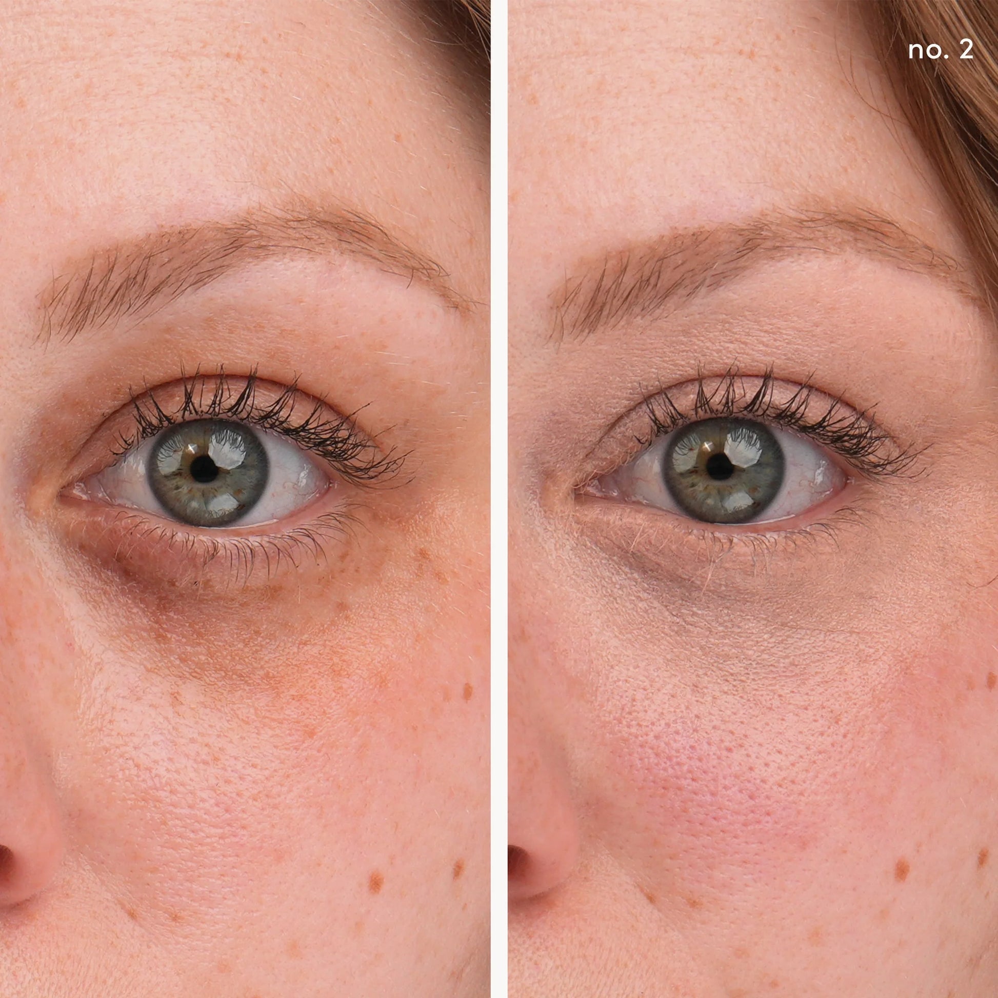 Split view of under-eye area showing Circle\Delete® Concealer's effect, reducing dark circles for brighter, even-toned skin with seamless, natural coverage.