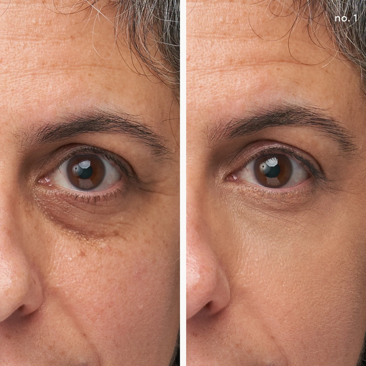 Enlighten Plus Under-eye Concealer reduces under-eye darkness and fine lines, smoothing skin with hydrating Hyaluronic Acid and CoQ10 for a brighter look.