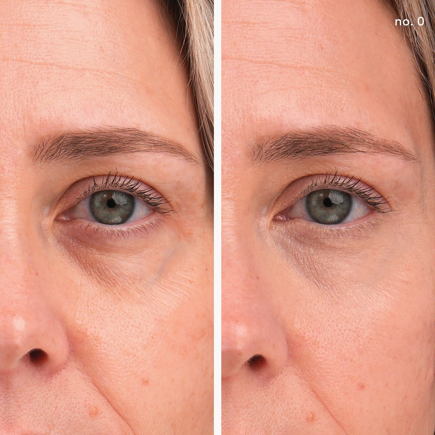 Before-and-after of eye area using Enlighten Plus Under-eye Concealer; showcases brightening and firming effects with buildable coverage.