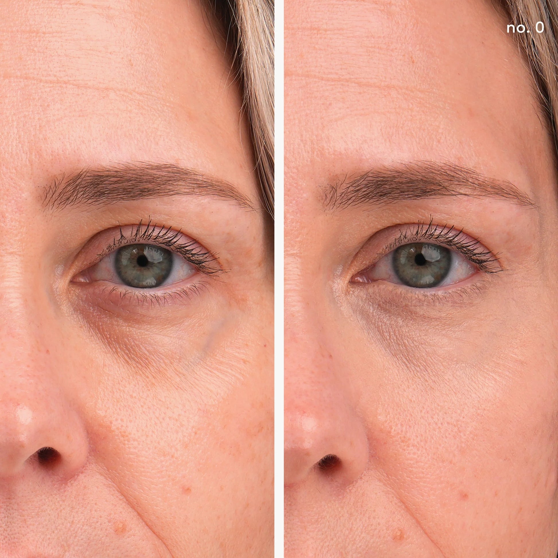 Before-and-after of eye area using Enlighten Plus Under-eye Concealer; showcases brightening and firming effects with buildable coverage.