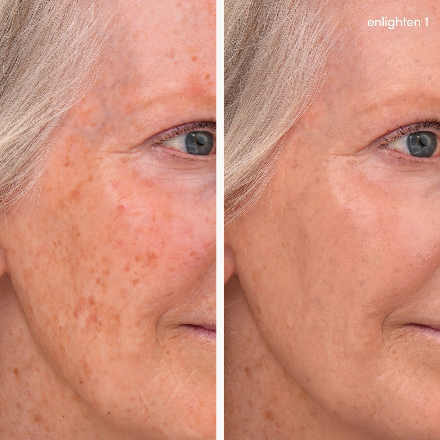 Side-by-side of an older person's cheek showing Enlighten Concealer™ effectiveness; left with spots, right smoother and even-toned.