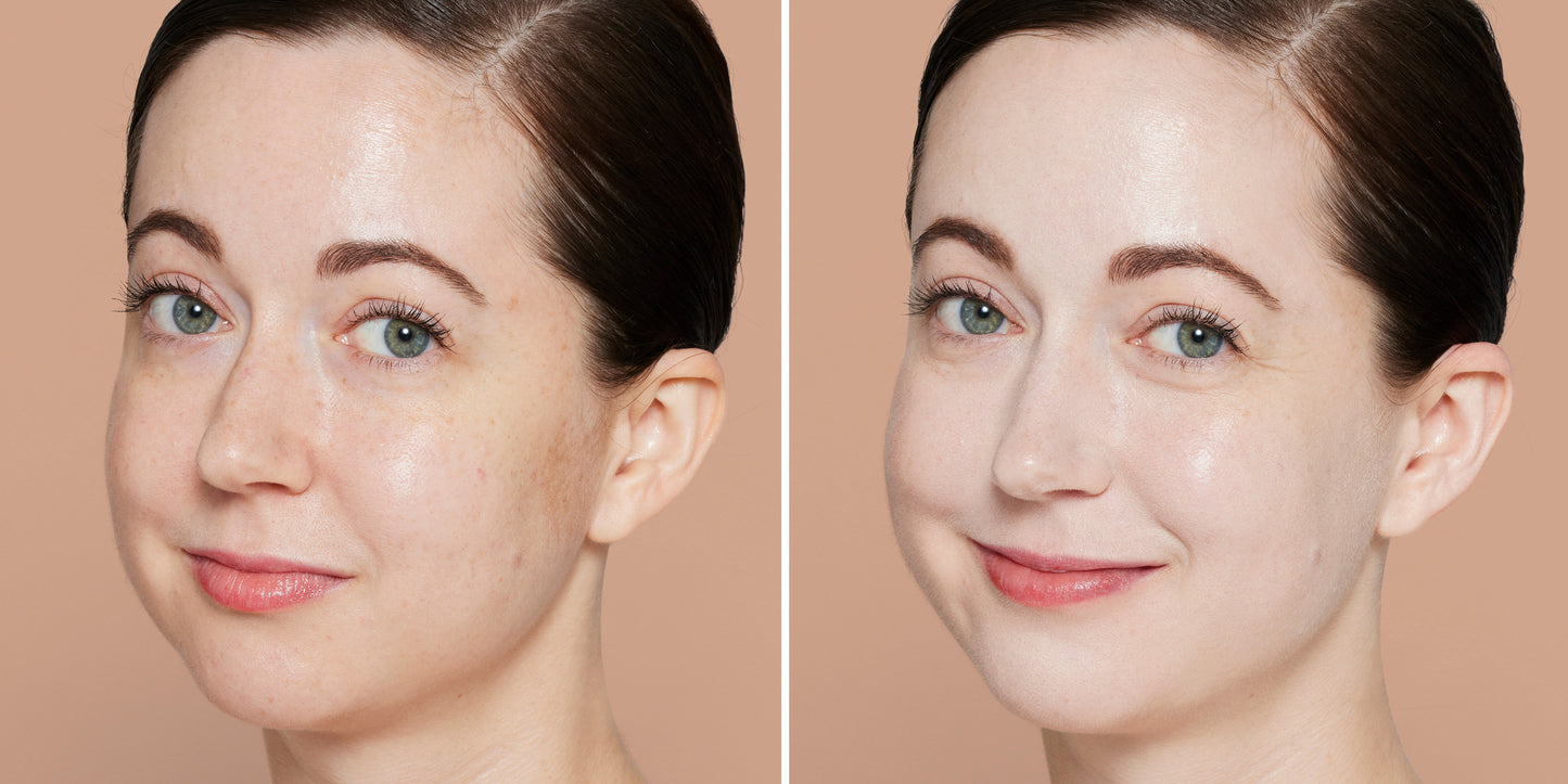 Young woman’s face before and after using Skintuition SPF 30 Radiance-Boosting Liquid Foundation, showcasing smoother, nourished skin with a luminous finish.