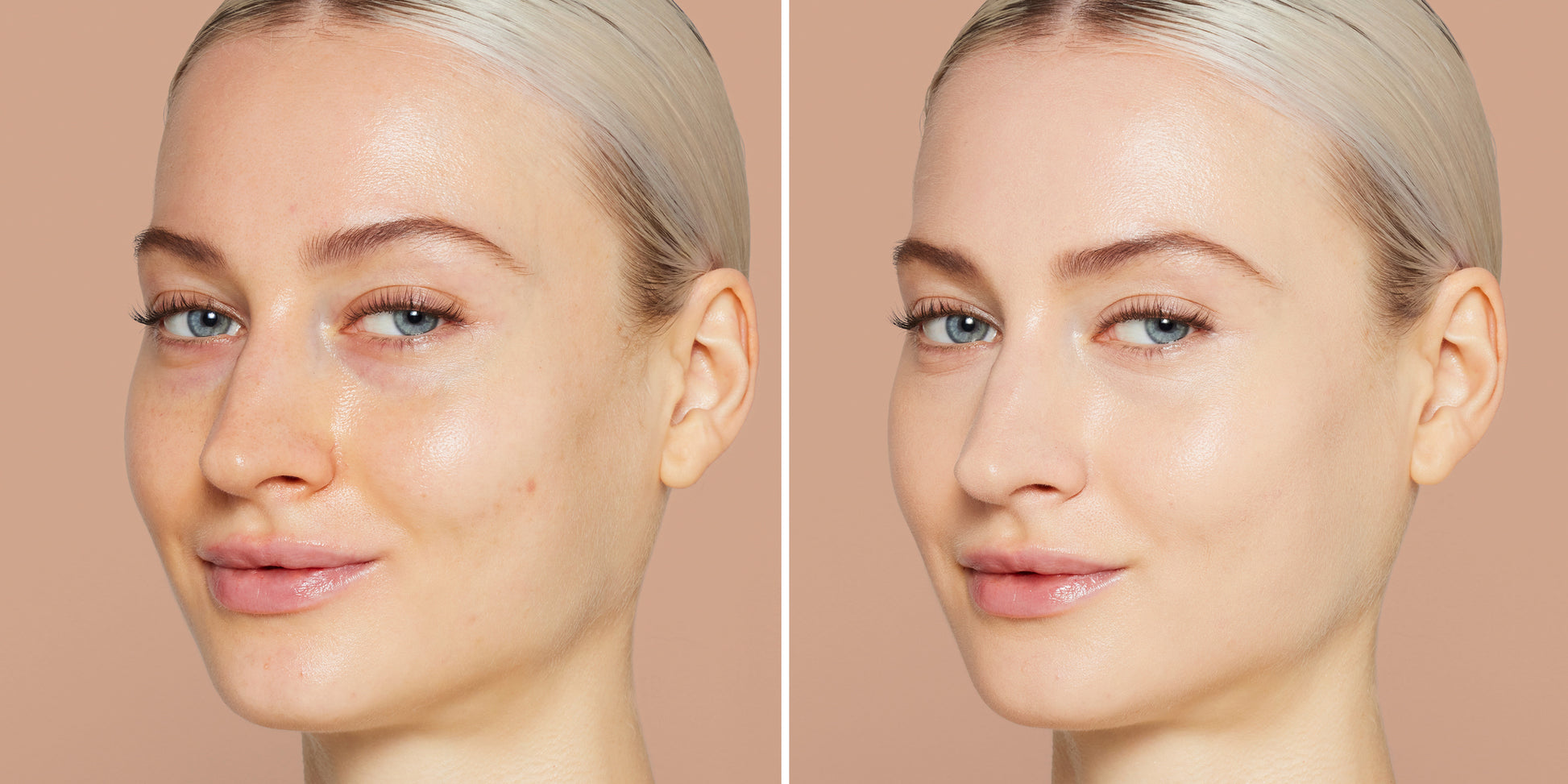Side-by-side of woman's face before and after using Skintuition SPF 30 Radiance-Boosting Liquid Foundation, showcasing smoother, even complexion.