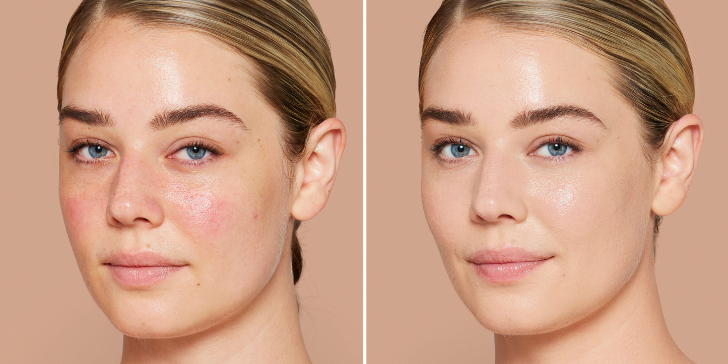Side-by-side of a woman's face before and after using Skintuition SPF 30 Radiance-Boosting Liquid Foundation, showing improved complexion and reduced redness.