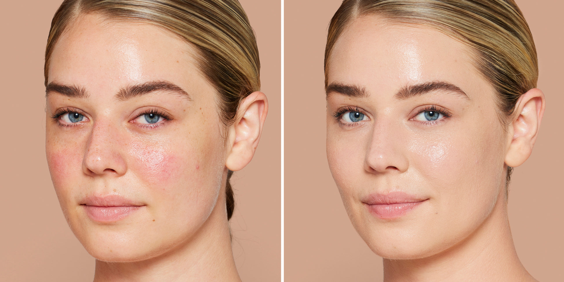 Side-by-side of a woman's face before and after using Skintuition SPF 30 Radiance-Boosting Liquid Foundation, showing improved complexion and reduced redness.