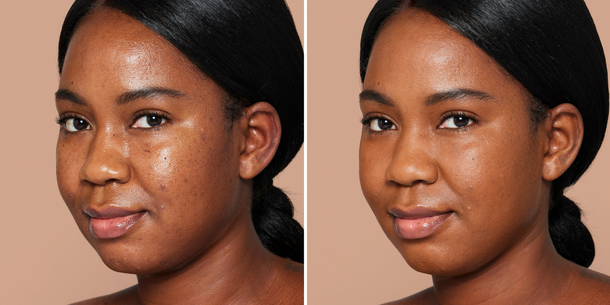 Before and after of woman using Skintuition SPF 30 Radiance-Boosting Liquid Foundation, showing smoother, even-toned skin, illustrating its effective, nourishing coverage.
