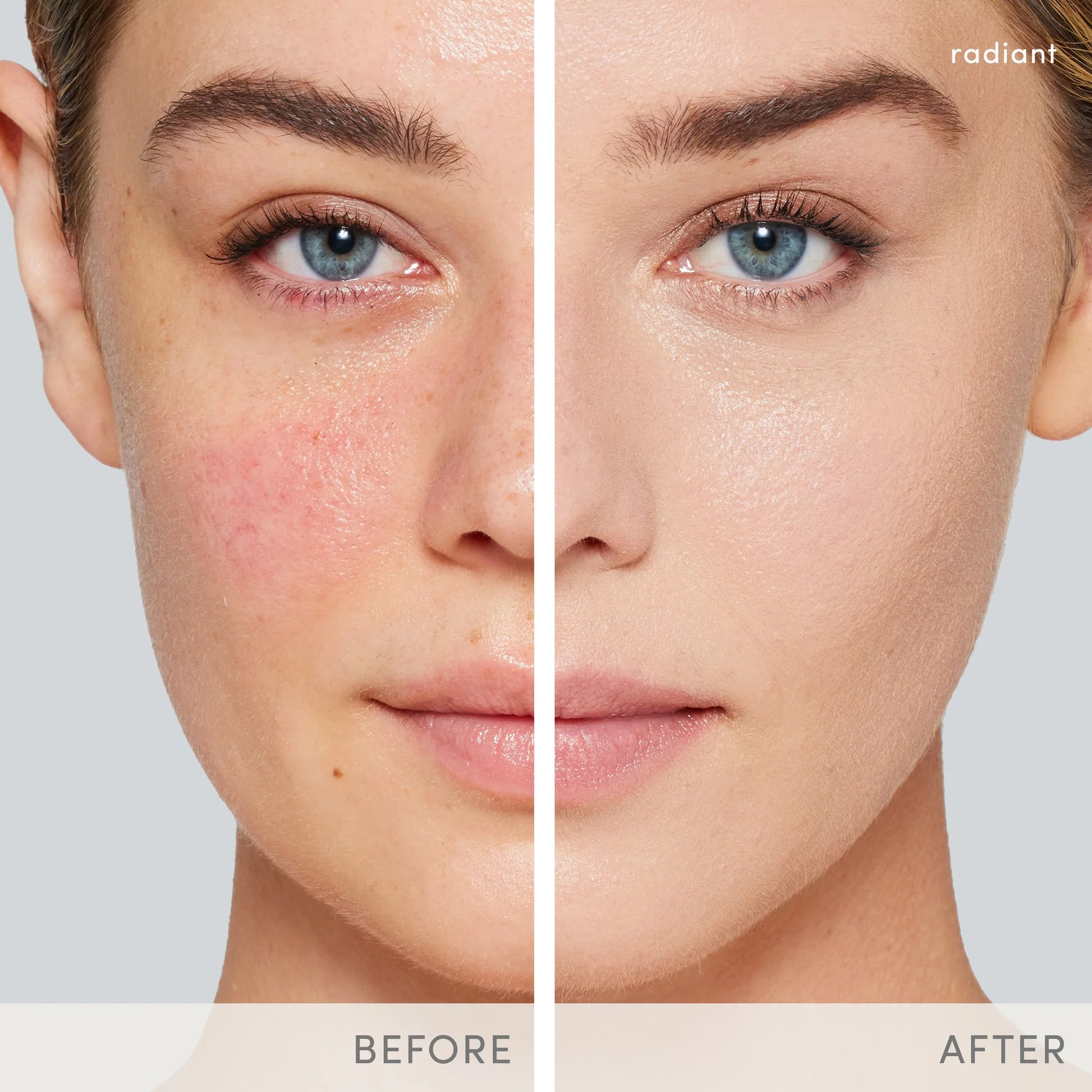 Before and after skincare image showing improved skin using Jane Iredale PurePressed® Base Mineral Foundation SPF 20/15.